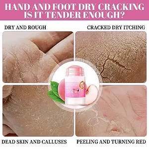 Крем для ног 3 шт для сухой и потрескавшейся кожи локтей коленей и рук с мочевиной synthetic.ua - Фото 1