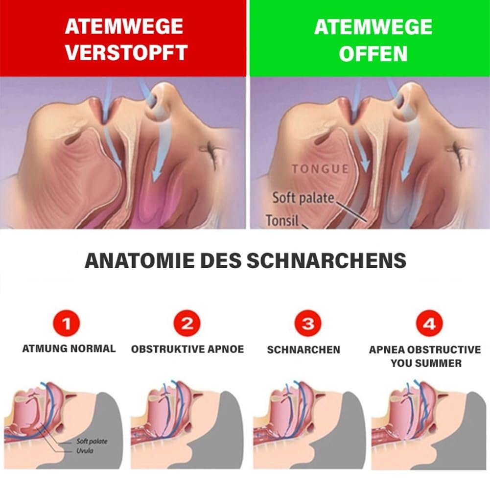 Пристрій проти хропіння Guggys для чоловіків і жінок, фото №4 Пристрій проти хропіння Guggys для чоловіків і жінок, фото №4
