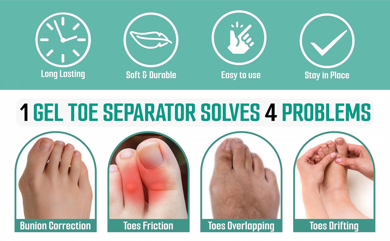 Роздільник для пальців ніг Pedimend Гелевий силіконовий захист для кісточки з розширювачем, фото №3