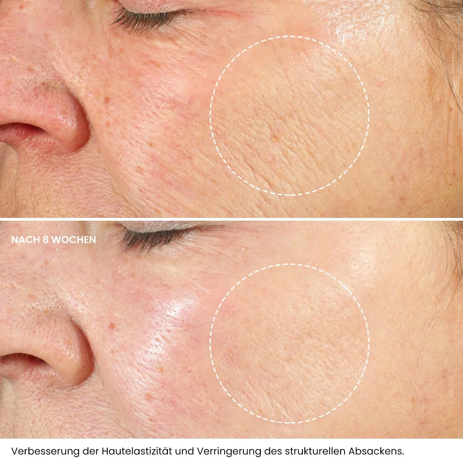 Крем для обличчя Kleem Retinol 2.5% Retinol Hyaluronic Acid Vitamin E Anti-Aging Day & Night, фото №2