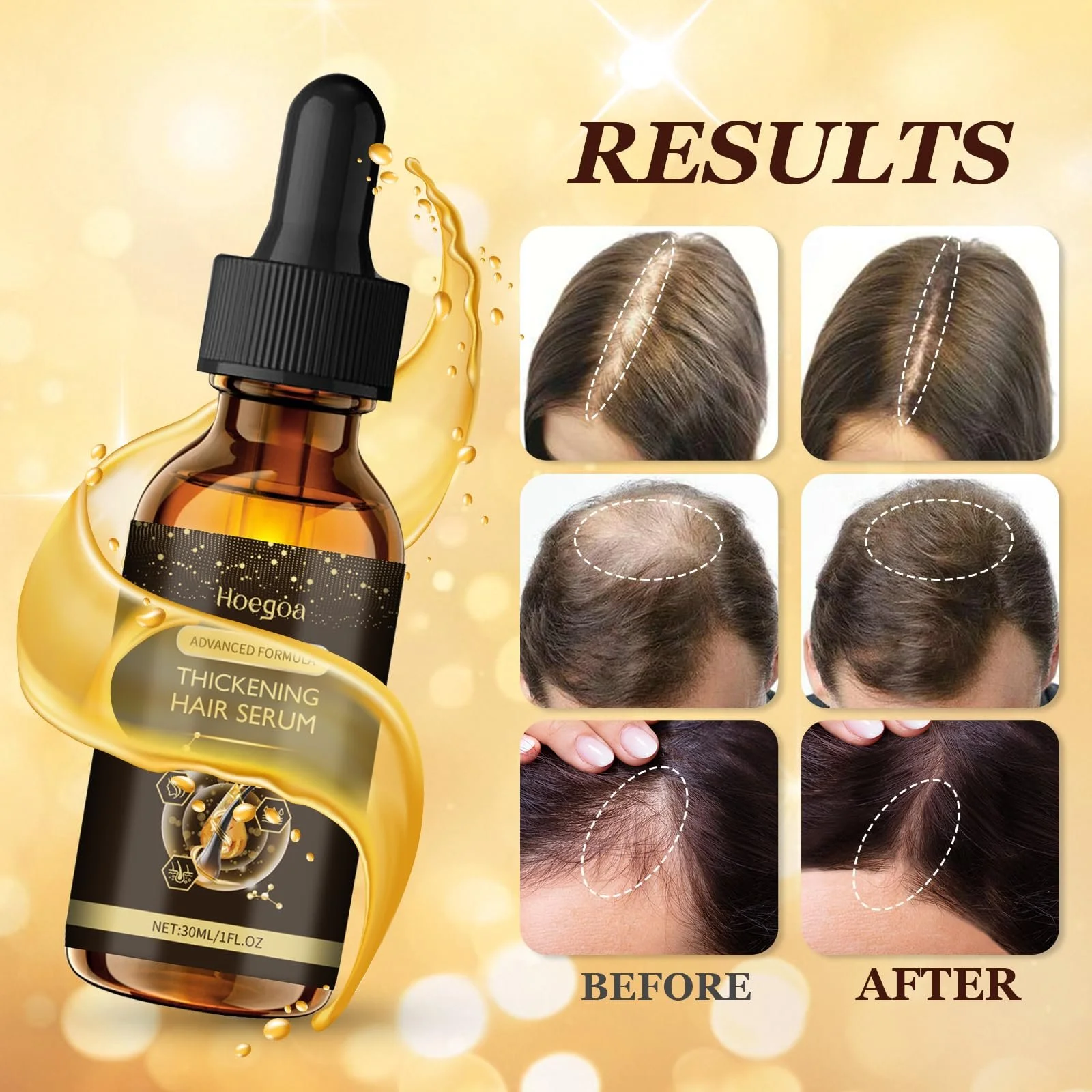 Сироватка для росту волосся Ledeak, 30 мл, фото №5