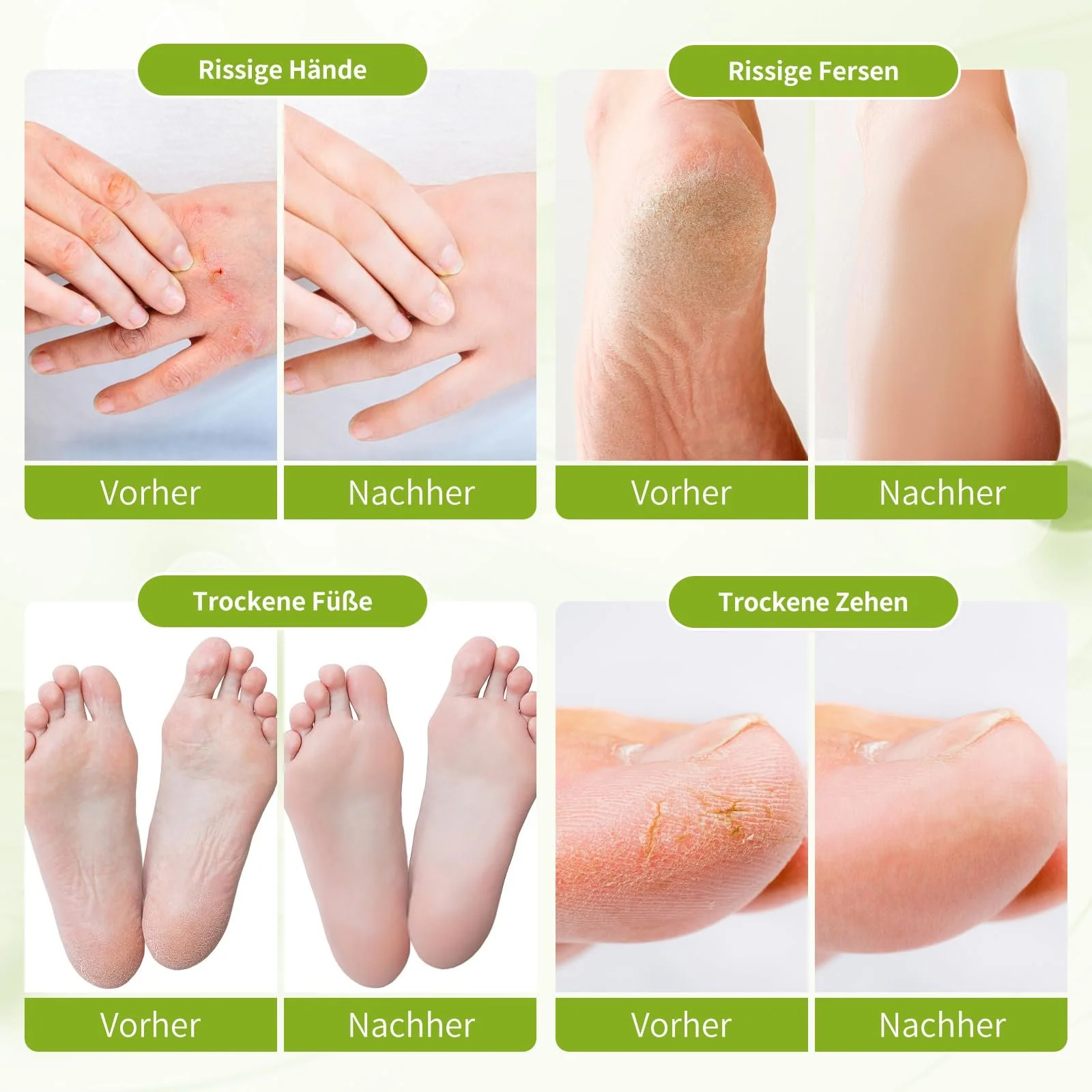 Крем для ног Callus Remover для удаления мозолей глубокое увлажнение и смягчение 80 мл лимон, фото №8