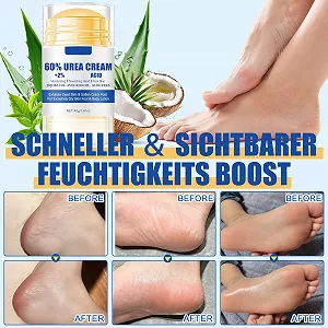 Крем-стик для ног 60% Urea Cream увлажняющий от трещин 40 г synthetic.ua - Фото 1