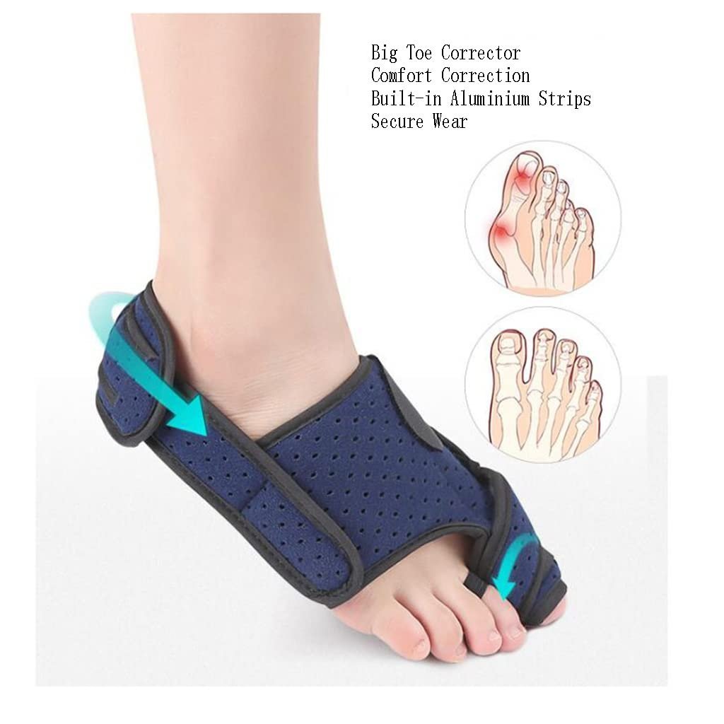 Випрямляч для пальців ніг Великий ортез Hallux Overlap, розпірка Hallux Valgus, ремінь для корекції шишки, фото №6