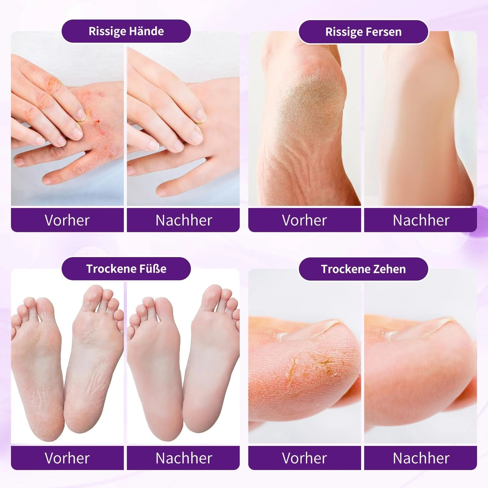 Крем для ухода за ногами Удаление мозолей Увлажняющий Лаванда 80 мл, фото №3 Крем для ухода за ногами Удаление мозолей Увлажняющий Лаванда 80 мл, фото №3