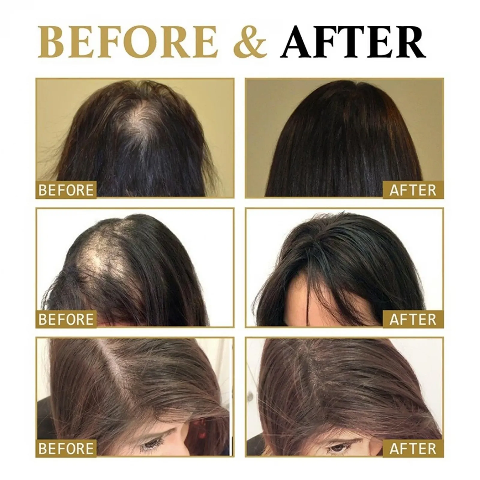 Сироватка для волосся з роликом Regrowth Organic, Засіб проти випадіння волосся, фото №4