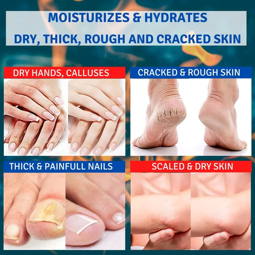 Набор кремов для ног TIS Urea 30% + Urea 15% AHA Wheat Germ Oil, фото №4