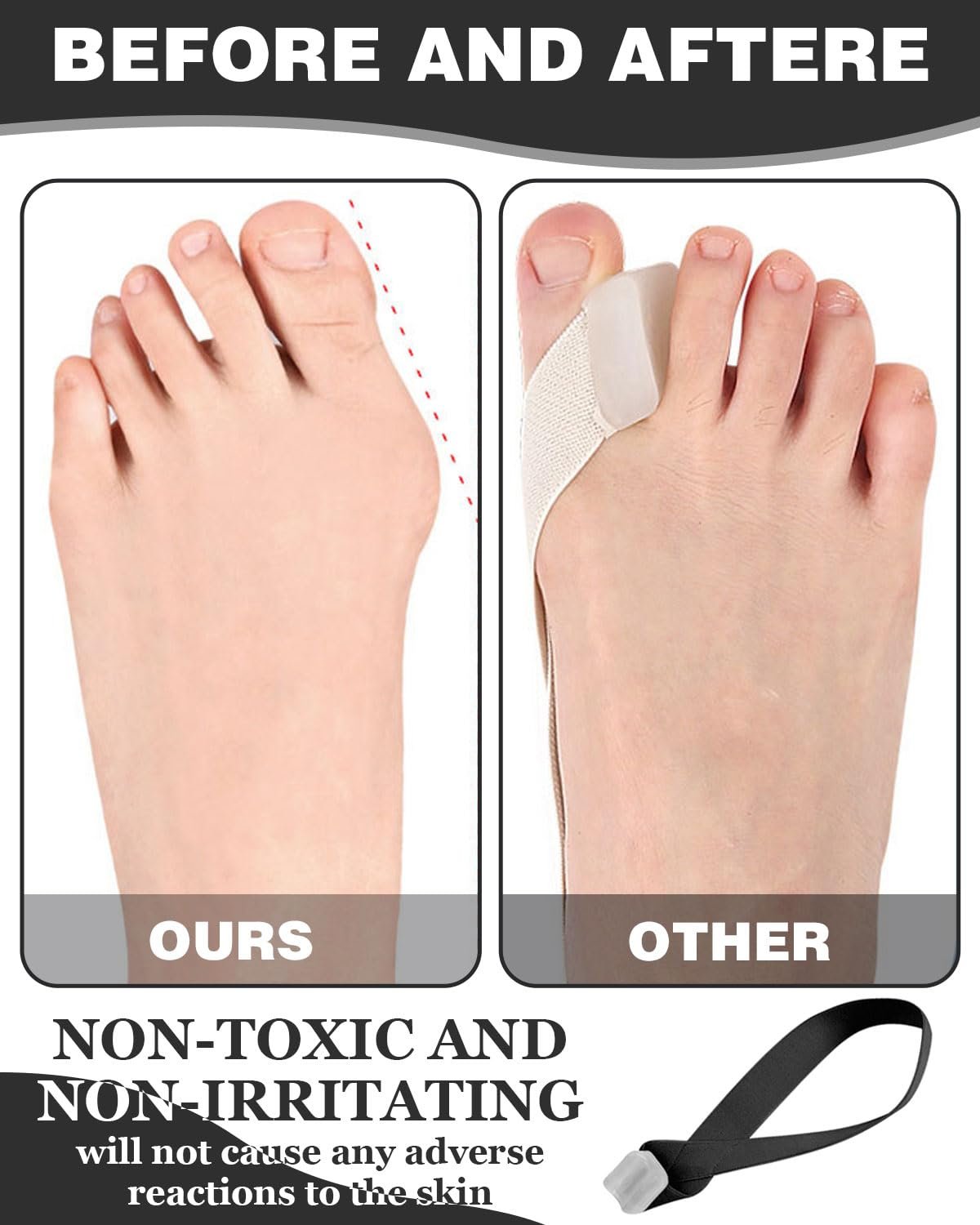 Комплект для корекції Hallux Valgus та роздільник для пальців ніг (2 штуки) М'який силікон для безболісної ходьби, фото №5 Комплект для корекції Hallux Valgus та роздільник для пальців ніг (2 штуки) М'який силікон для безболісної ходьби, фото №5