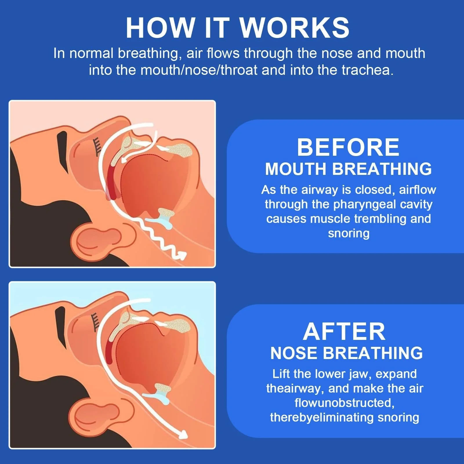 Капа от храпа 1 шт, Эффективное средство, фото №3 Капа от храпа 1 шт, Эффективное средство, фото №3