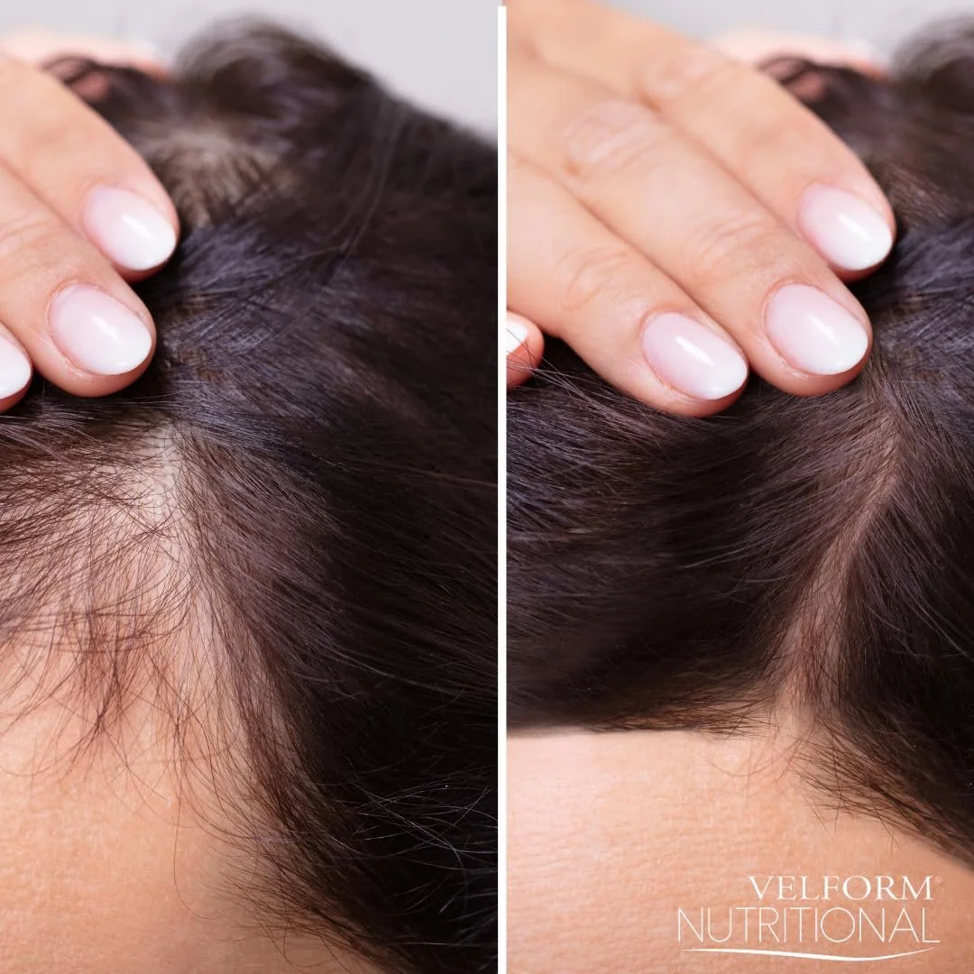 Лосьйон Velform Nutritional для стимуляції росту волосся та запобігання випадінню 8 вітамінів, збільшує густоту 200 мл, фото №7