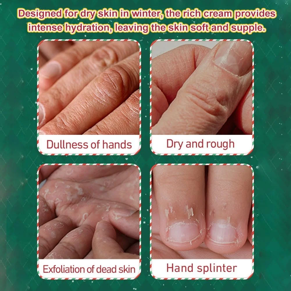 Набір для подарунків: крем для рук і лосьйон для тіла на Різдво - 2 x 100 мл, фото №2