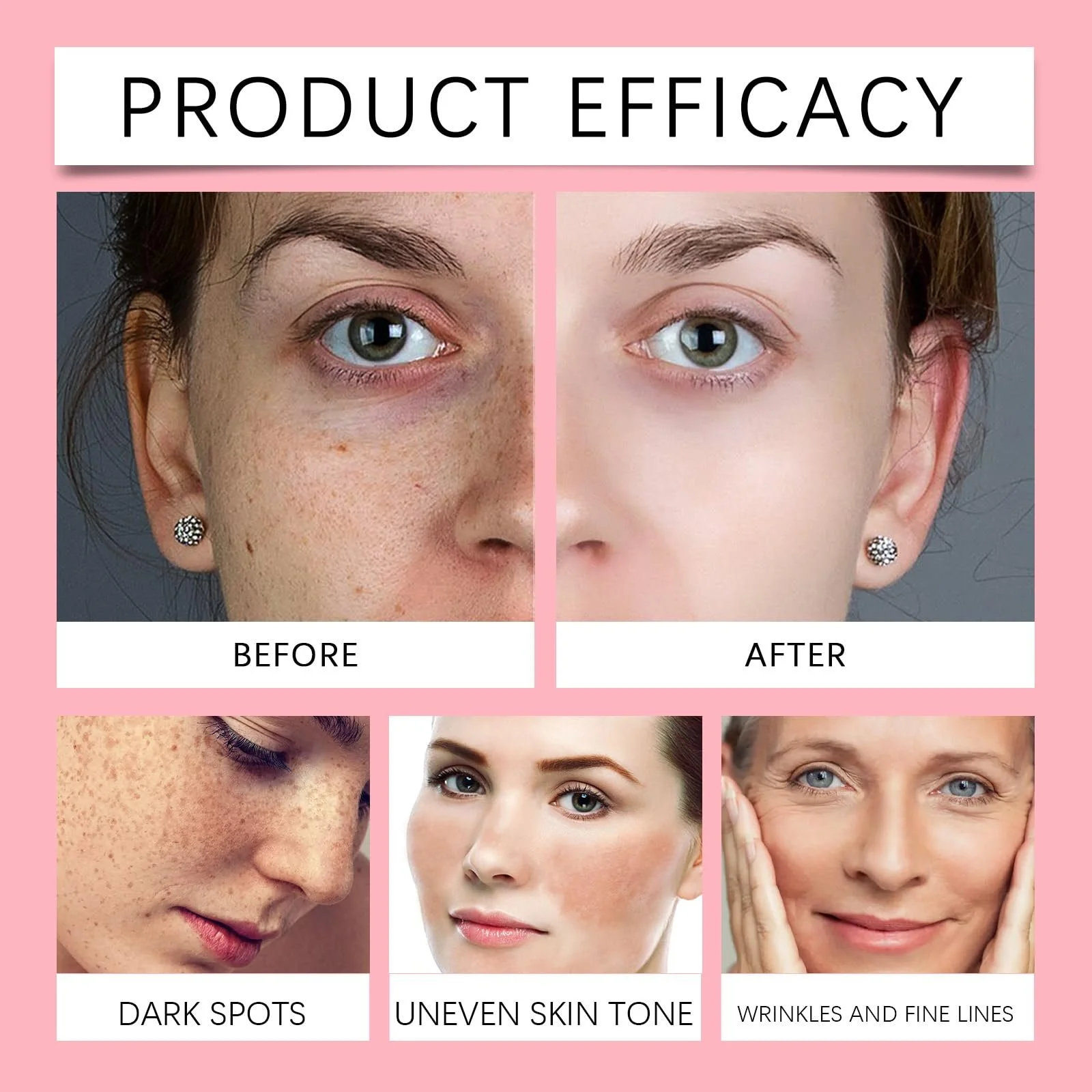 Маска для лица пленочная Rosen, гидрогелевые маски для лица в желеобразных увлажнителях, порошковая маска для лица желе, порошковая маска для лица для косметолога спа-салона, уход за кожей, гидро маска для лица, фото №3