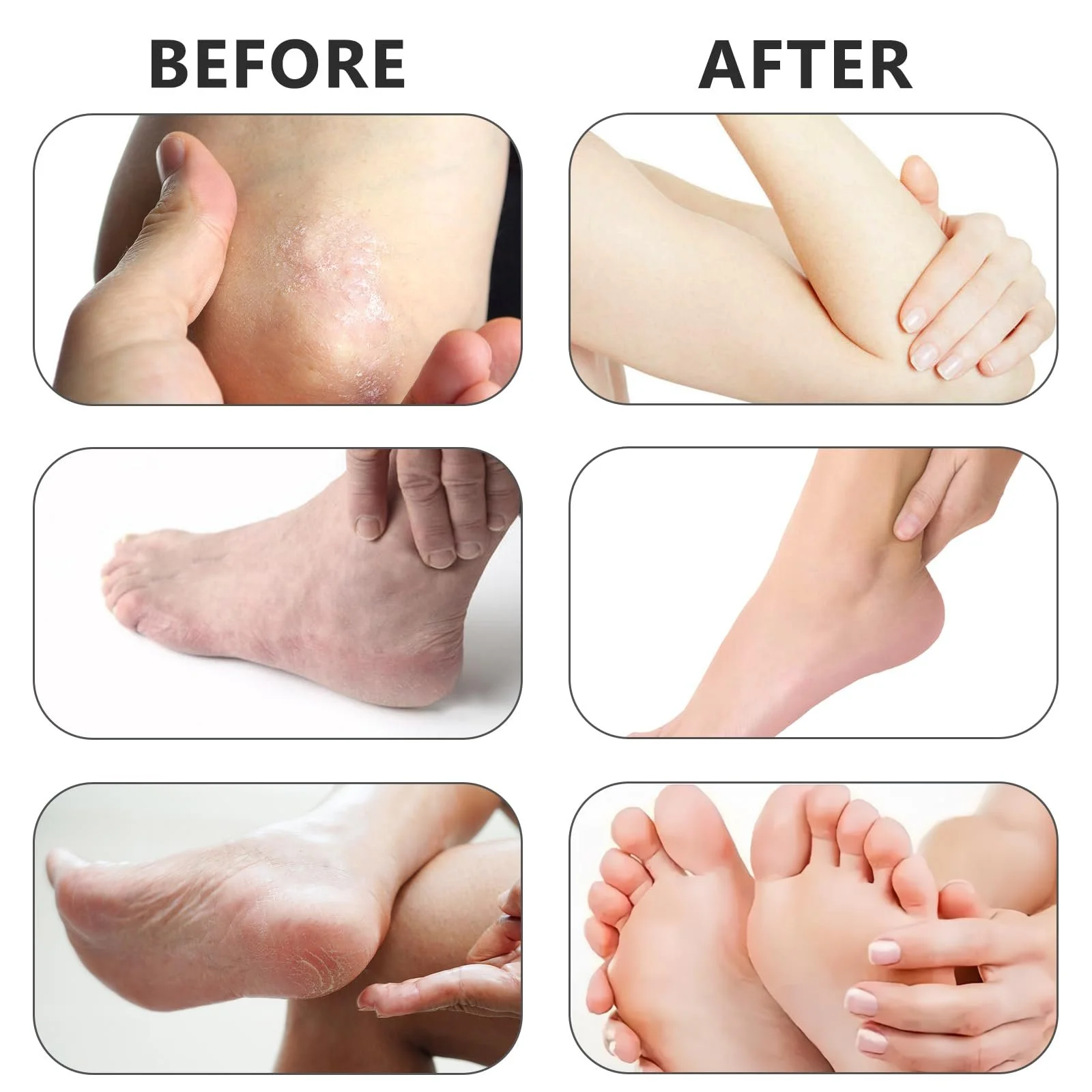 Стик-крем для ног увлажняющий с мочевиной 60% от трещин, фото №5