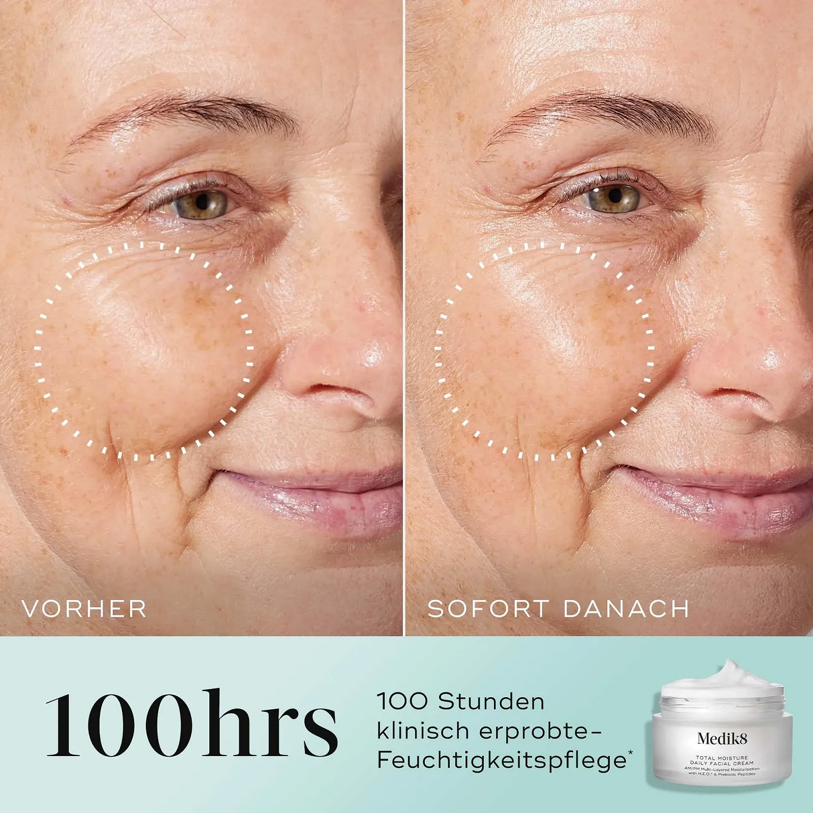 Денний та нічний крем для обличчя Medik8 Total Moisture Daily Hyaluronic Acid 50 мл, фото №3 Денний та нічний крем для обличчя Medik8 Total Moisture Daily Hyaluronic Acid 50 мл, фото №3
