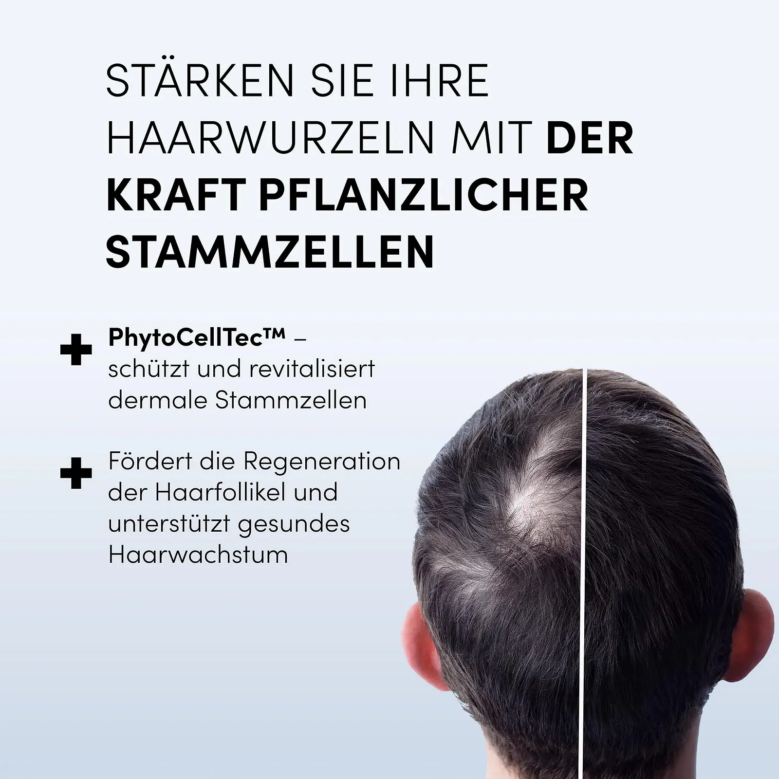 Сироватка проти випадіння волосся Dr. Balwi з Procapil& AnaGain, зміцнює коріння волосся, стимулює ріст волосся, 5 флаконів по 6 мл, фото №3