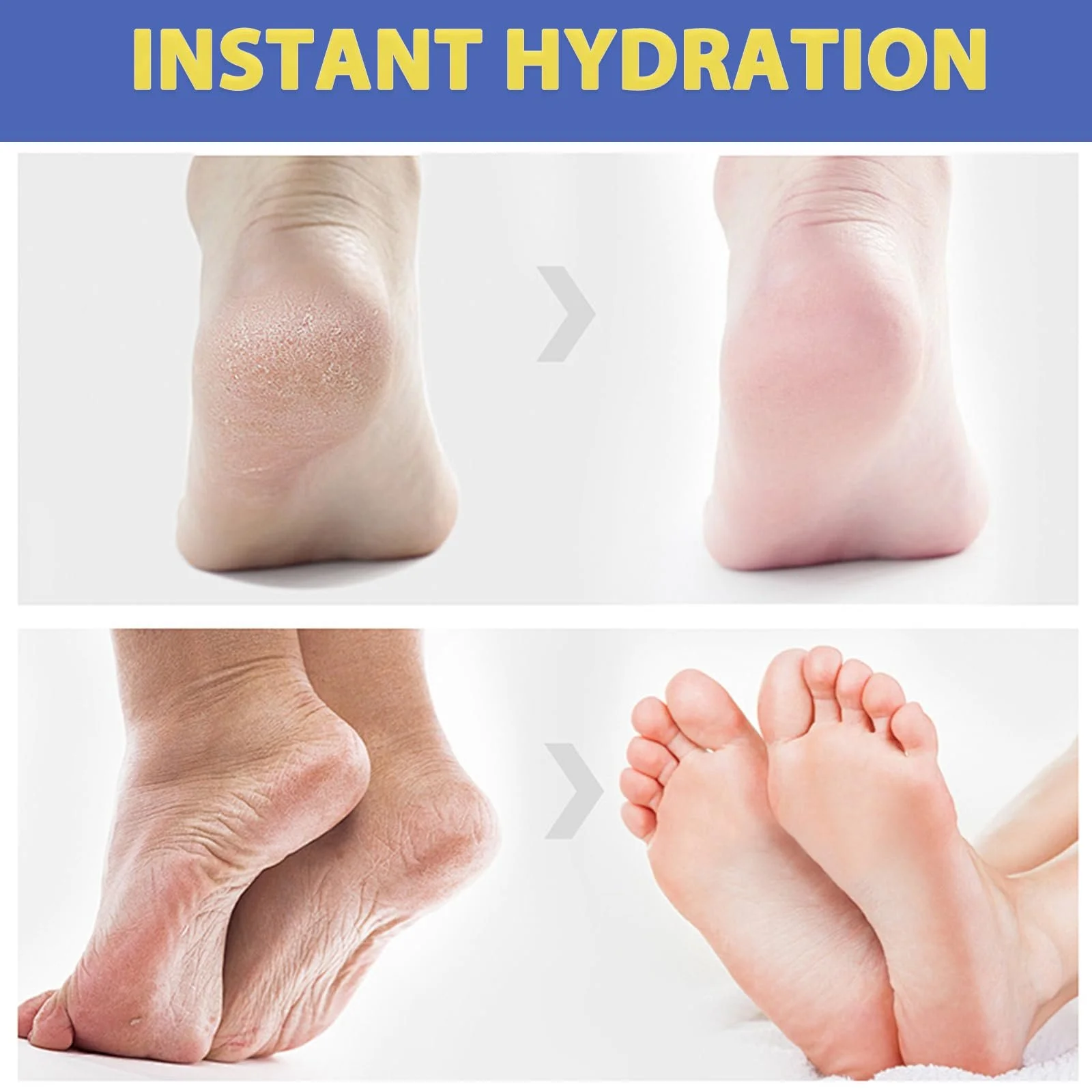 Крем для ног Urea 60% увлажняющий против трещин 2 шт, фото №5