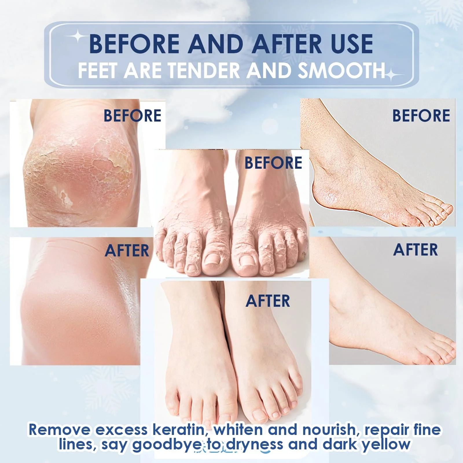 Крем для ног и рук Urea Cream с мочевиной 40% для сухой и огрубевшей кожи, фото №4