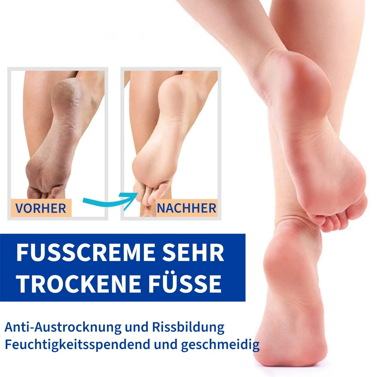 Крем для ног увлажняющий против трещин с салициловой кислотой для сухой кожи пяток и локтей, фото №5