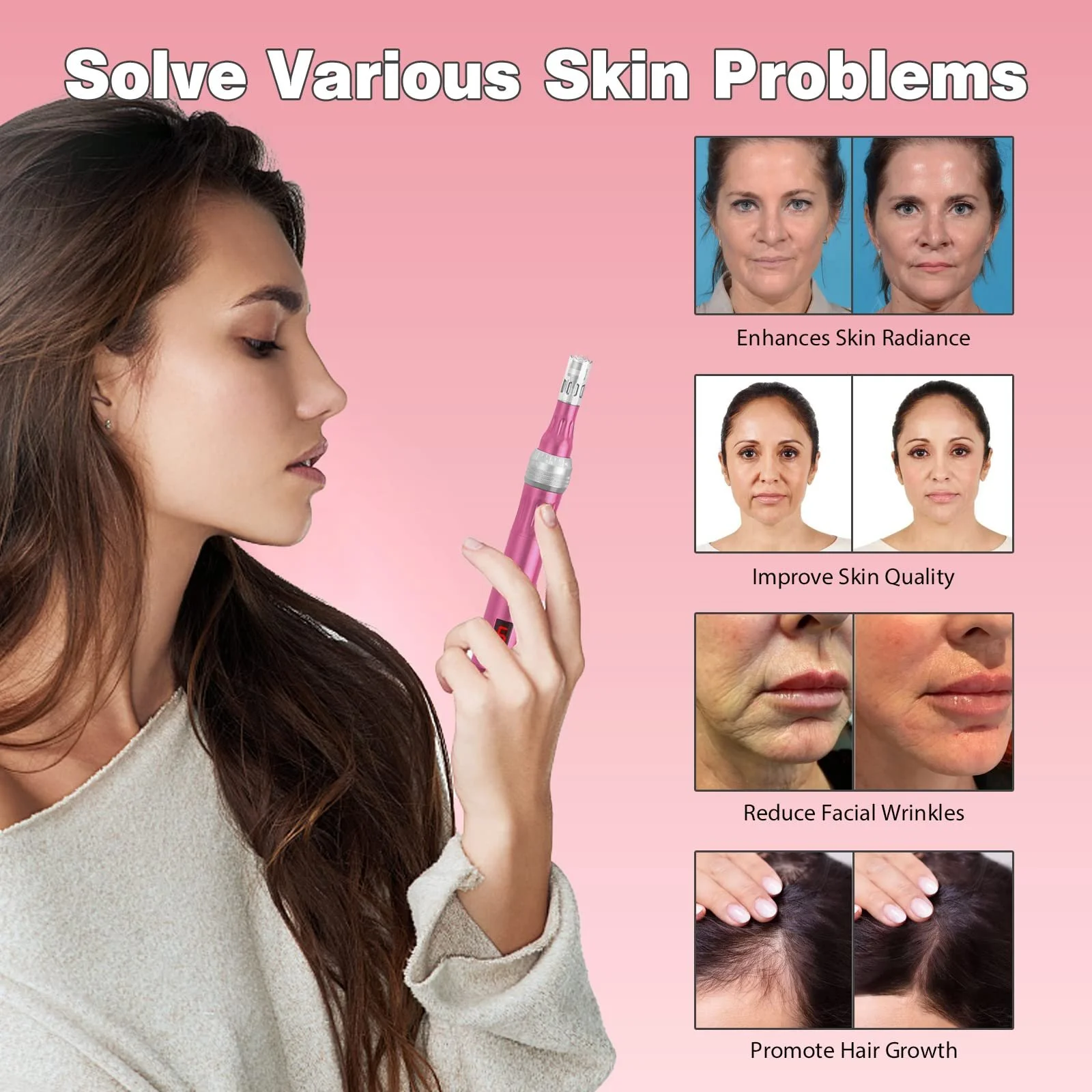 Пристрій для мікронідлінгу INCELLICE Derma Pen Electric Professional, 5 рівнів, зі світлодіодним екраном, фото №6