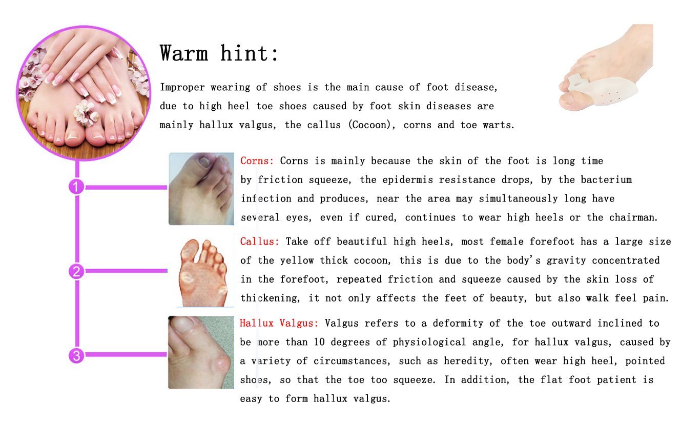 Роздільник для пальців ніг Elitzia Гель Hallux Valgus Коректор Захист і догляд за ногами, фото №7