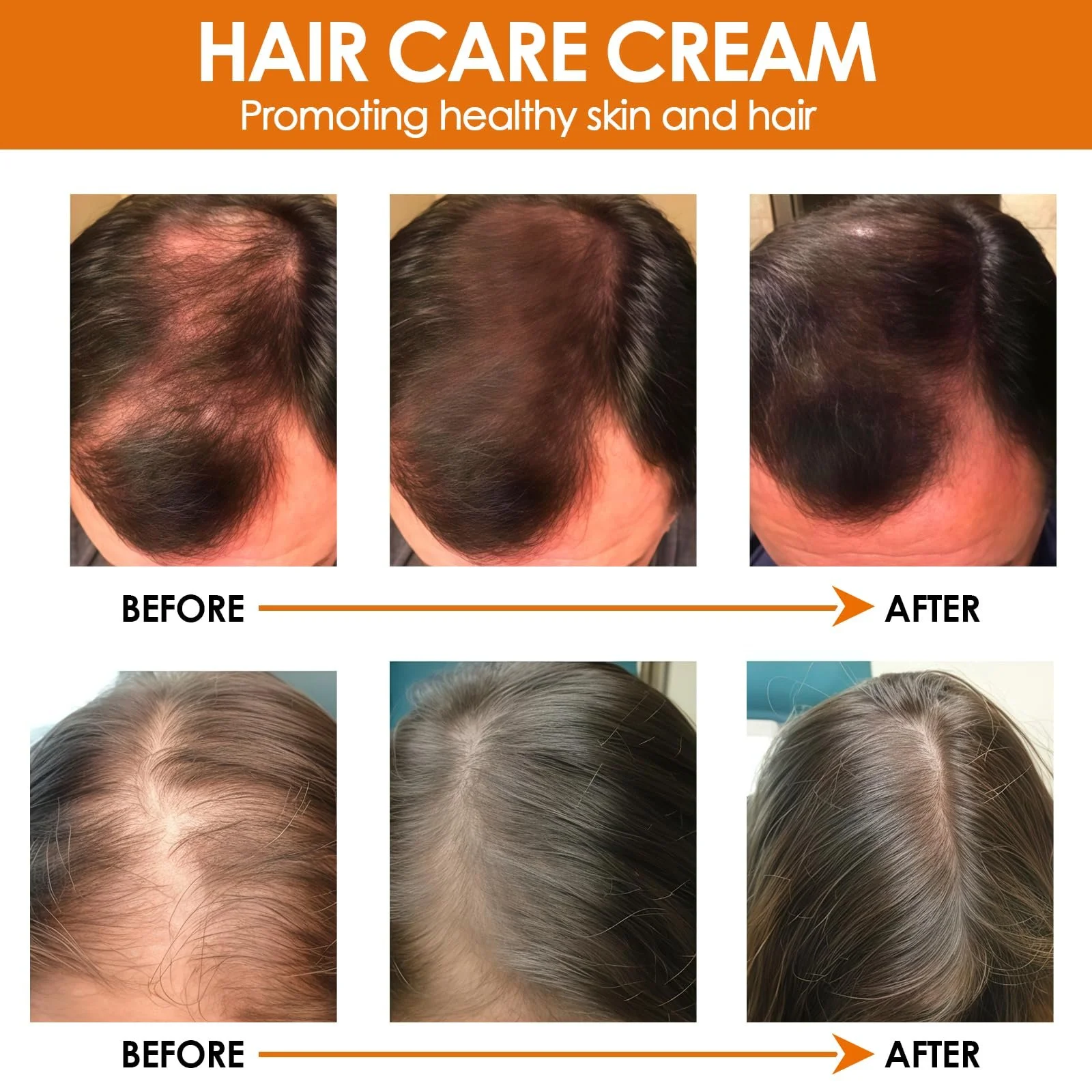 Крем для росту волосся 45 г, Набір для догляду за волоссям для росту волосся, фото №4 Крем для росту волосся 45 г, Набір для догляду за волоссям для росту волосся, фото №4