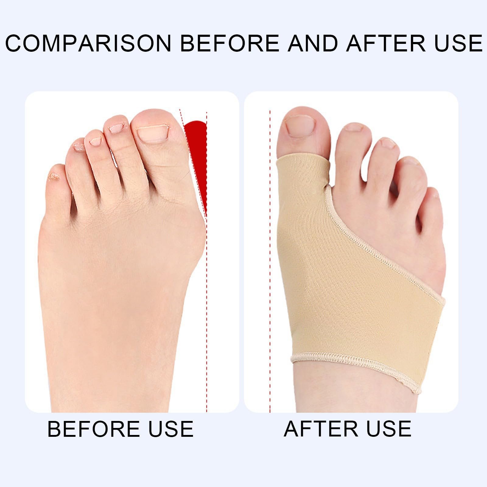 Шкарпетки для корекції великого пальця ноги AYNKH, коректор вальгусної деформації, фото №7