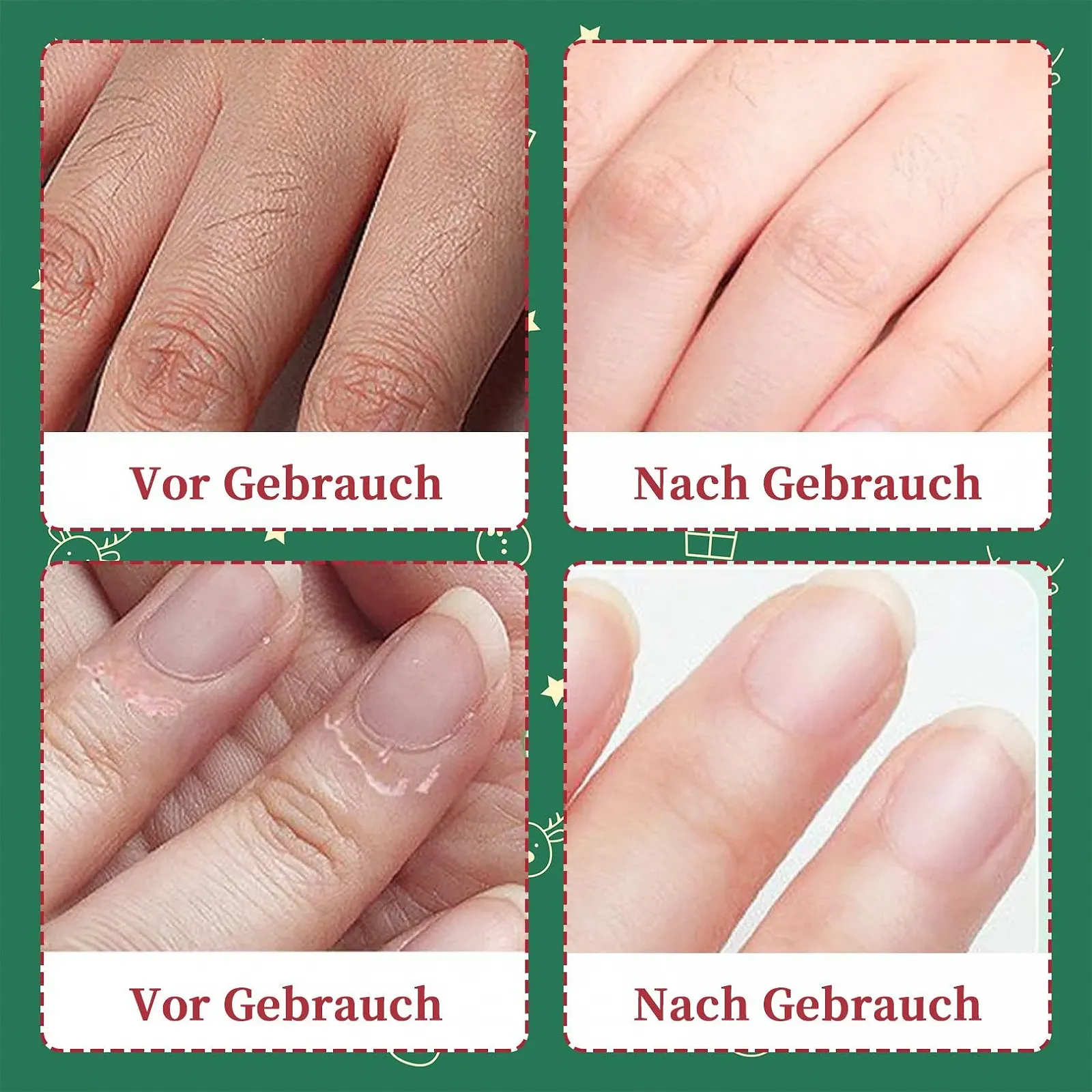 Набір для різдвяного догляду 8 штук, 4 x Міні-крем для рук, 4 x Догляд для губ, фото №5