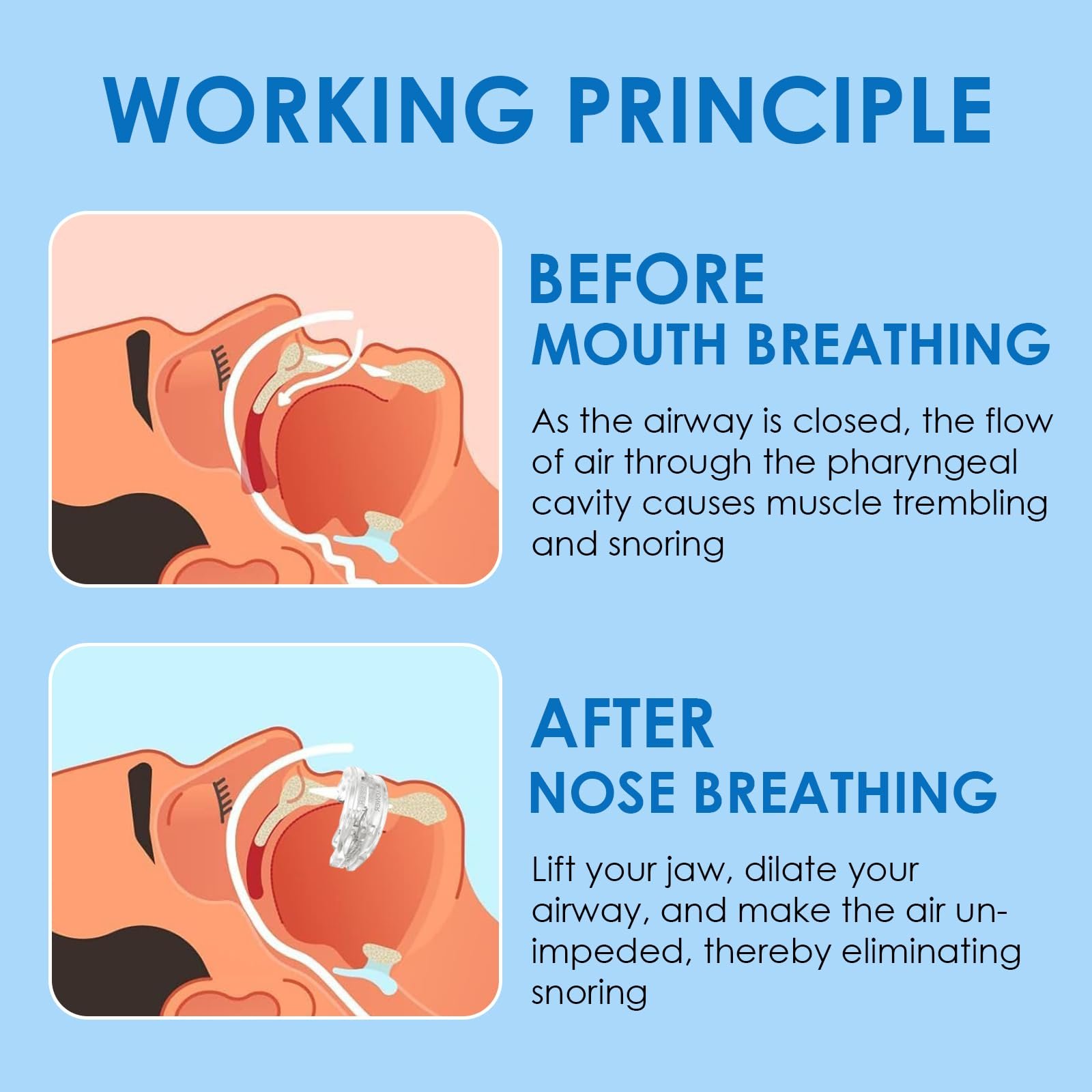 Капа від хропіння, прозора, фото №3