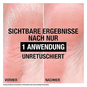 Крем для ног Neutrogena Norwegian Formula для потрескавшихся пяток 50 мл synthetic.ua - Фото 1