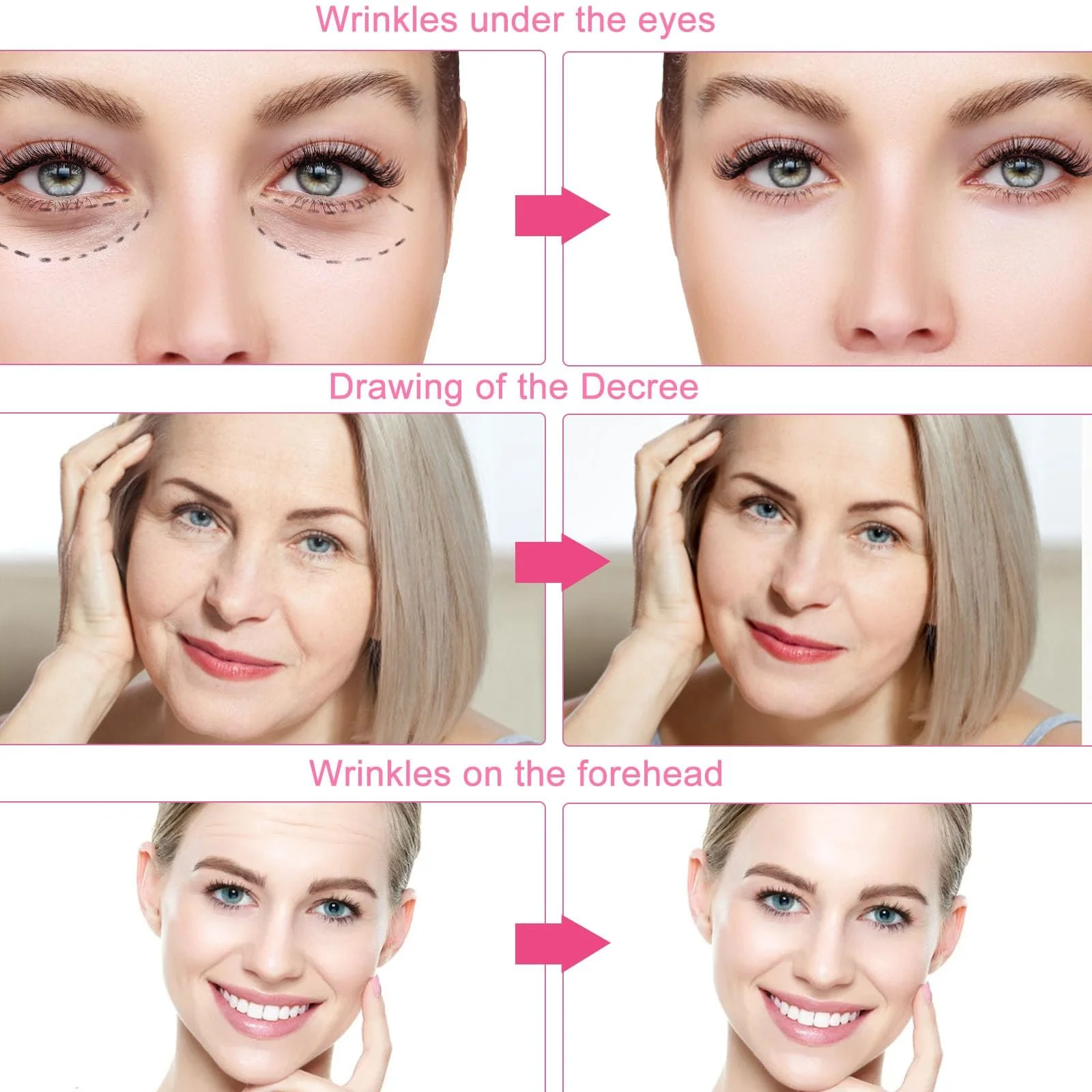 2 рулони стрічки для підтяжки обличчя, пластир проти зморшок, фото №5