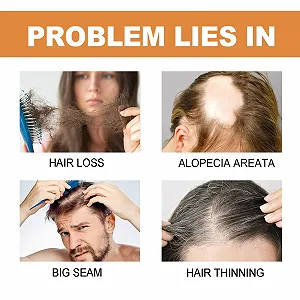 Ампулы для укрепления волос, Сыворотка для роста волос, Ампулы для глубокого ухода за волосами, Сыворотка для более густых, длинных, объемных и здоровых волос synthetic.ua - Фото 1