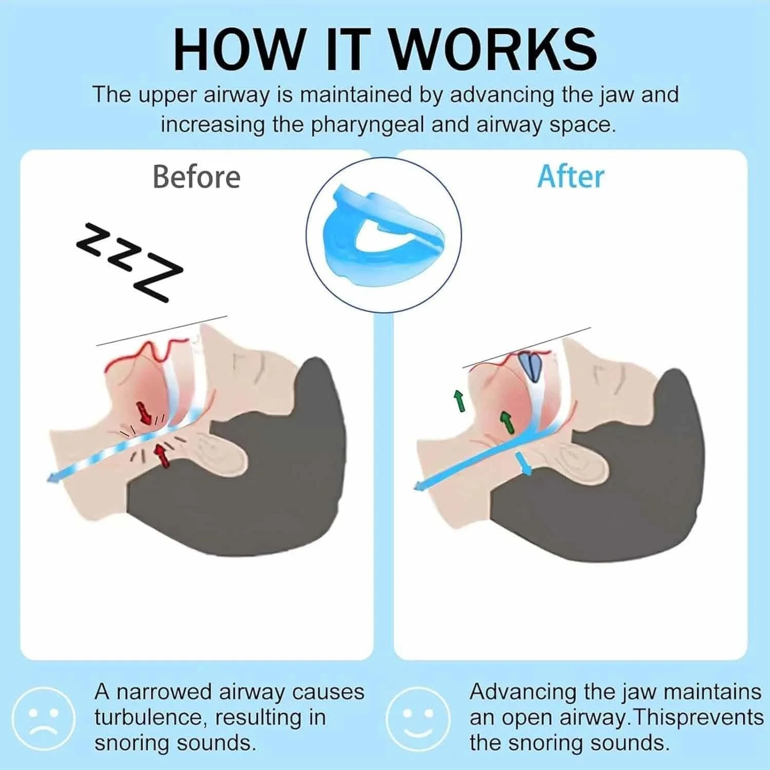 Ротовой Аппарат против Храп Honex Универсальный Размер, фото №3