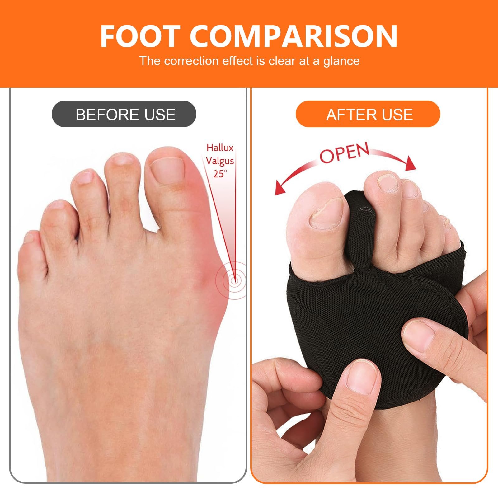 Пов'язка Hallux Valgus 1 пара, Роздільник для пальців ніг Hallux Valgus з 2 шт, фото №5