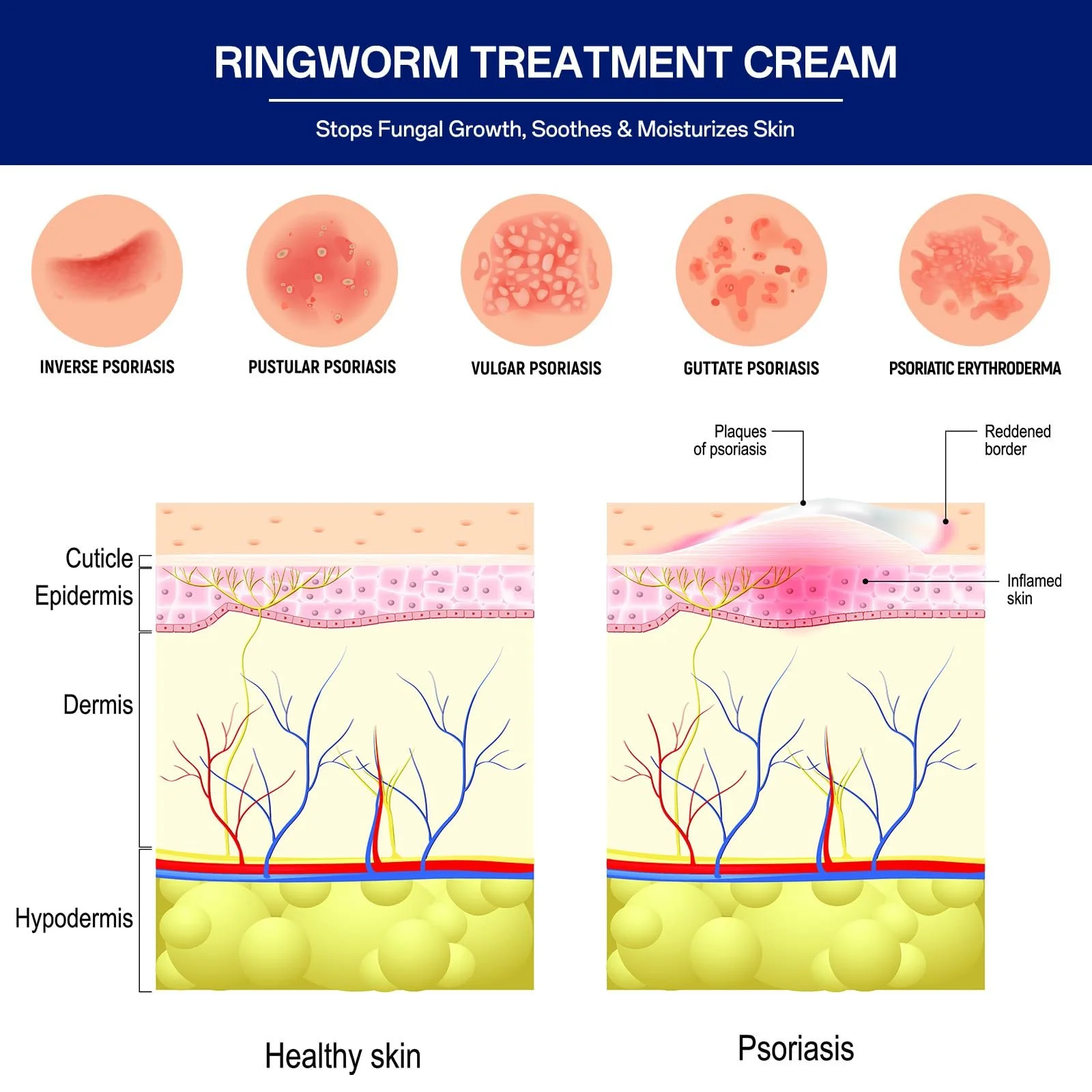 Крем протигрибковий Швидкої дії 20 г, фото №6