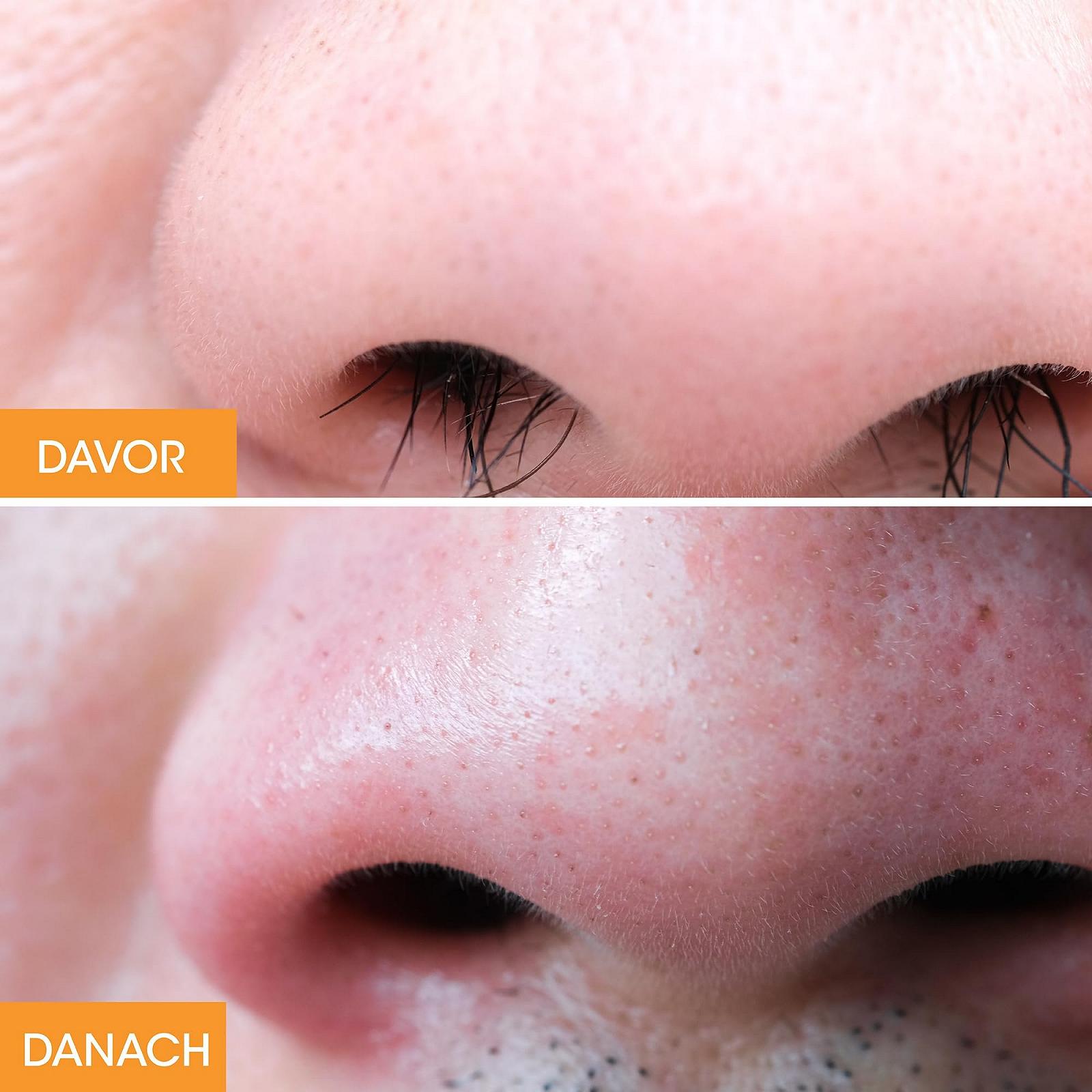 Набор для депиляции воском Nad's Nose Hair Wax для носа, фото №9