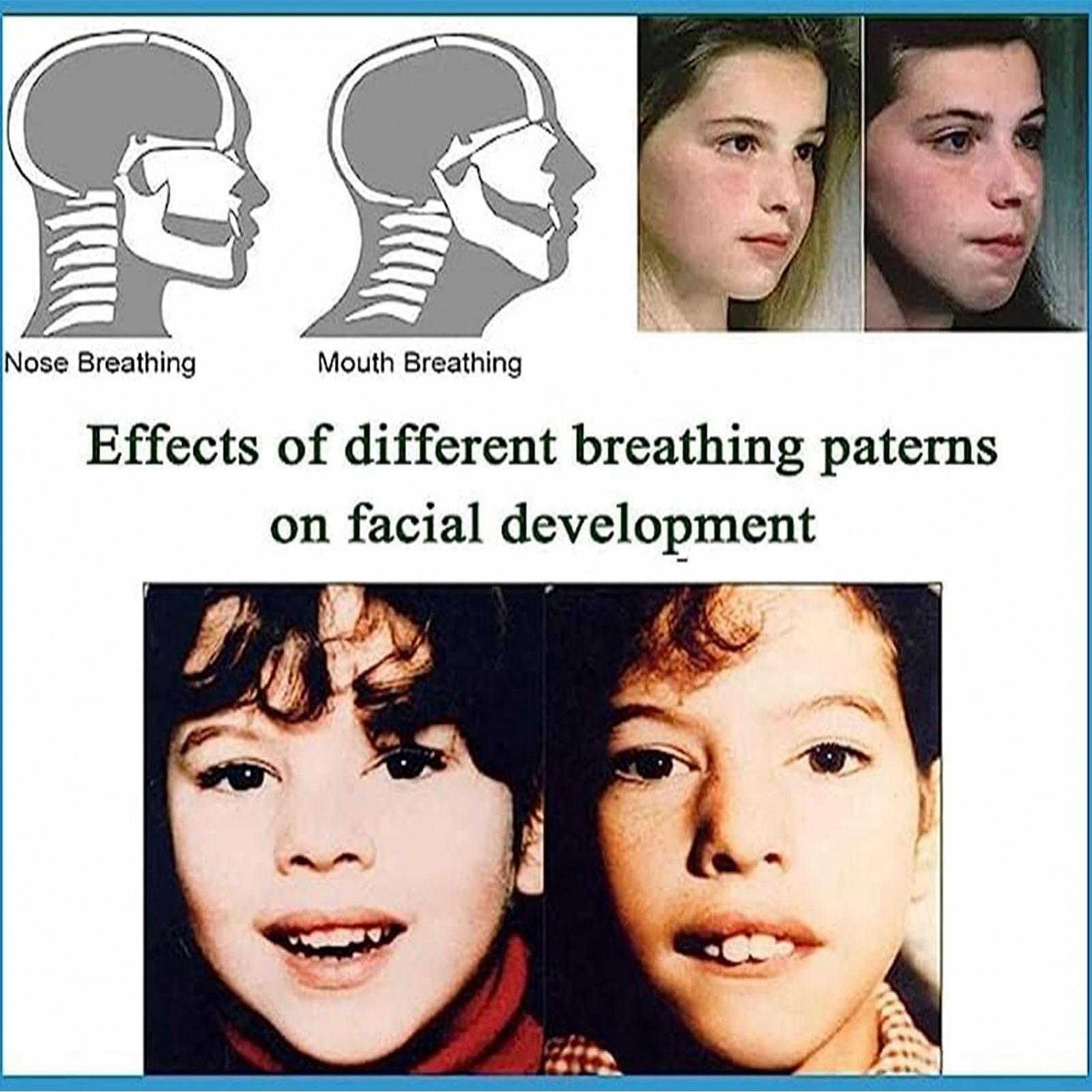 Смужка для сну на рот, упаковка 240 шт, фото №7