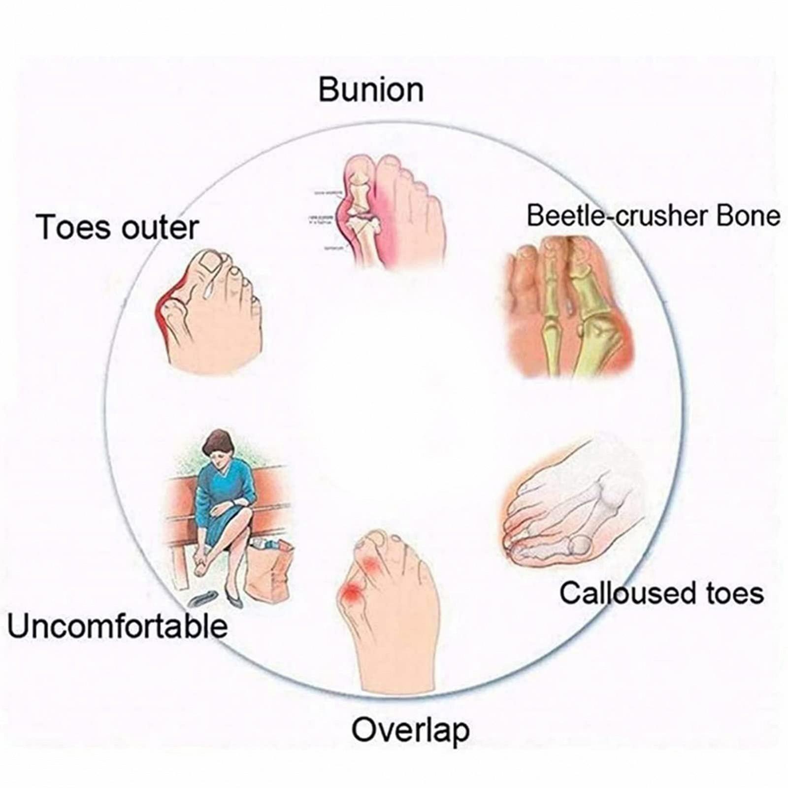 Женские Шлепанцы для коррекции стопы Золотой, фото №4