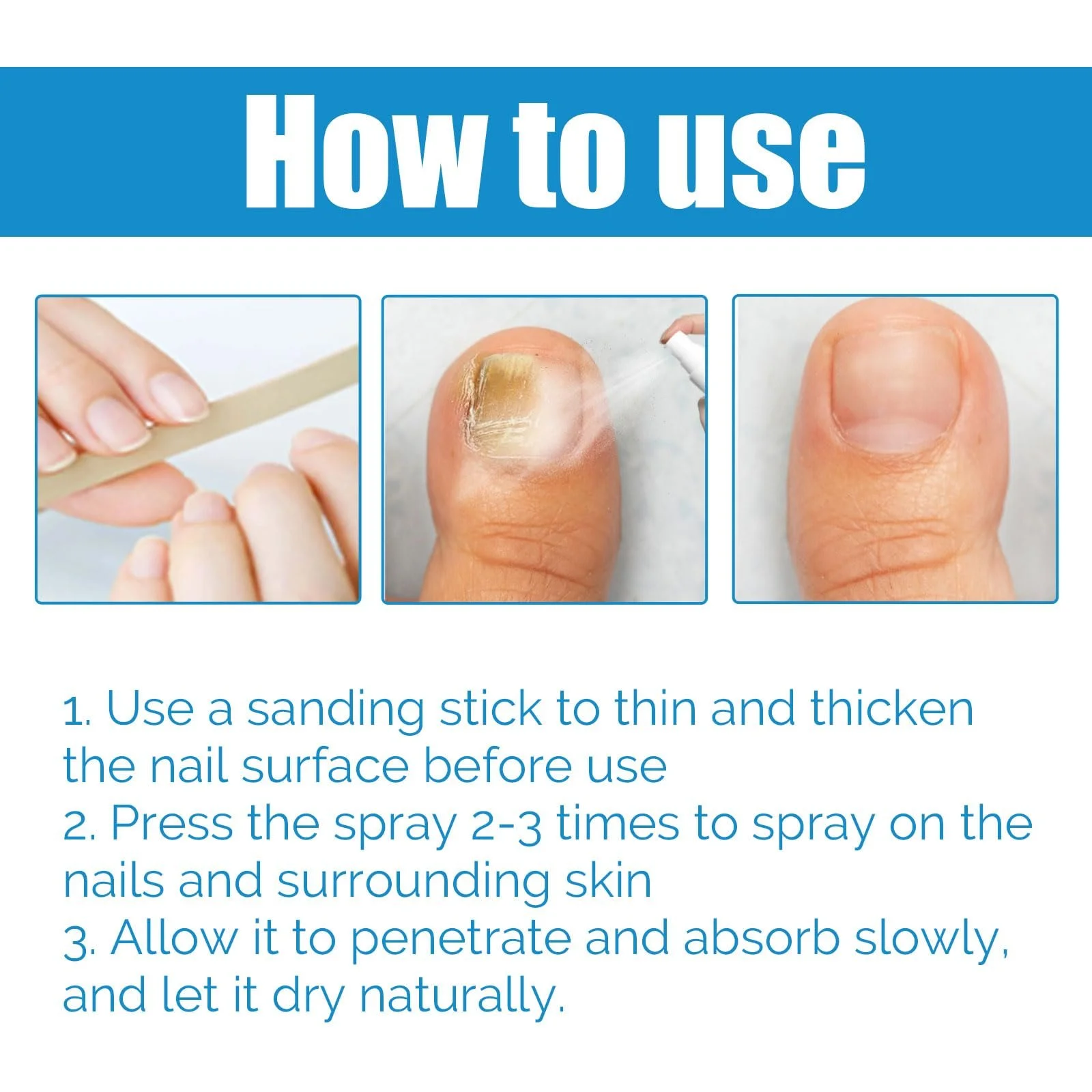 Спрей для догляду за ногами та нігтями захисний 100 мл, фото №6