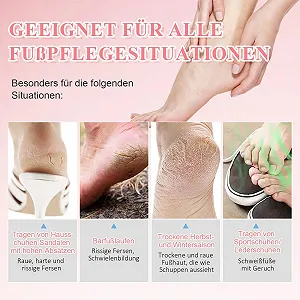 Крем для ног Foot Cream Against Callus Watermelon для сухой кожи и против мозолей synthetic.ua - Фото 1