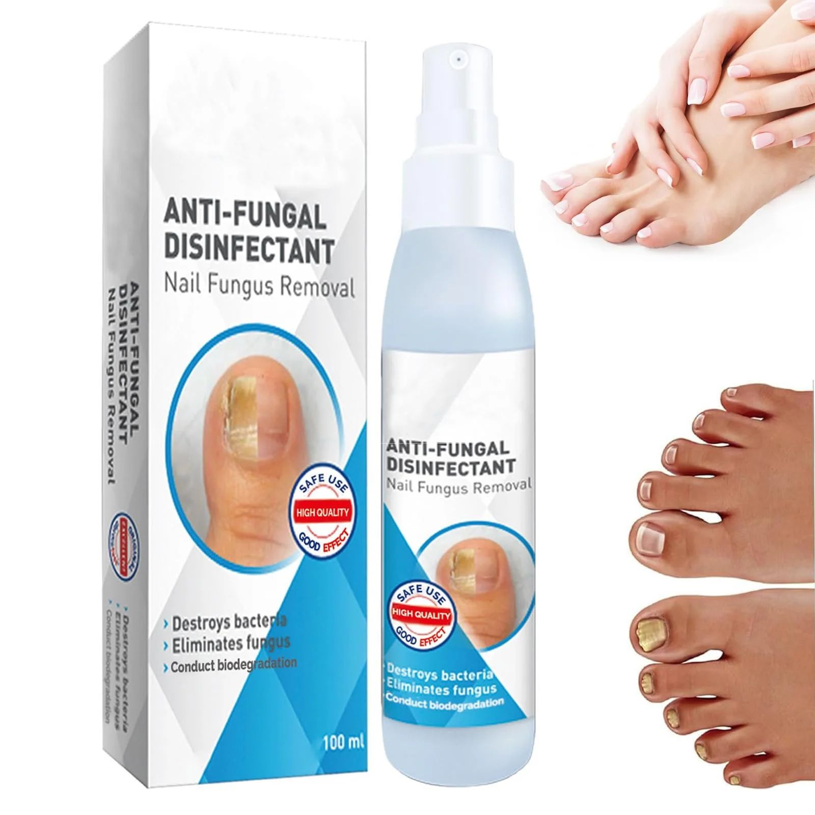 Спрей для догляду за ногами та нігтями захисний 100 мл, фото №1