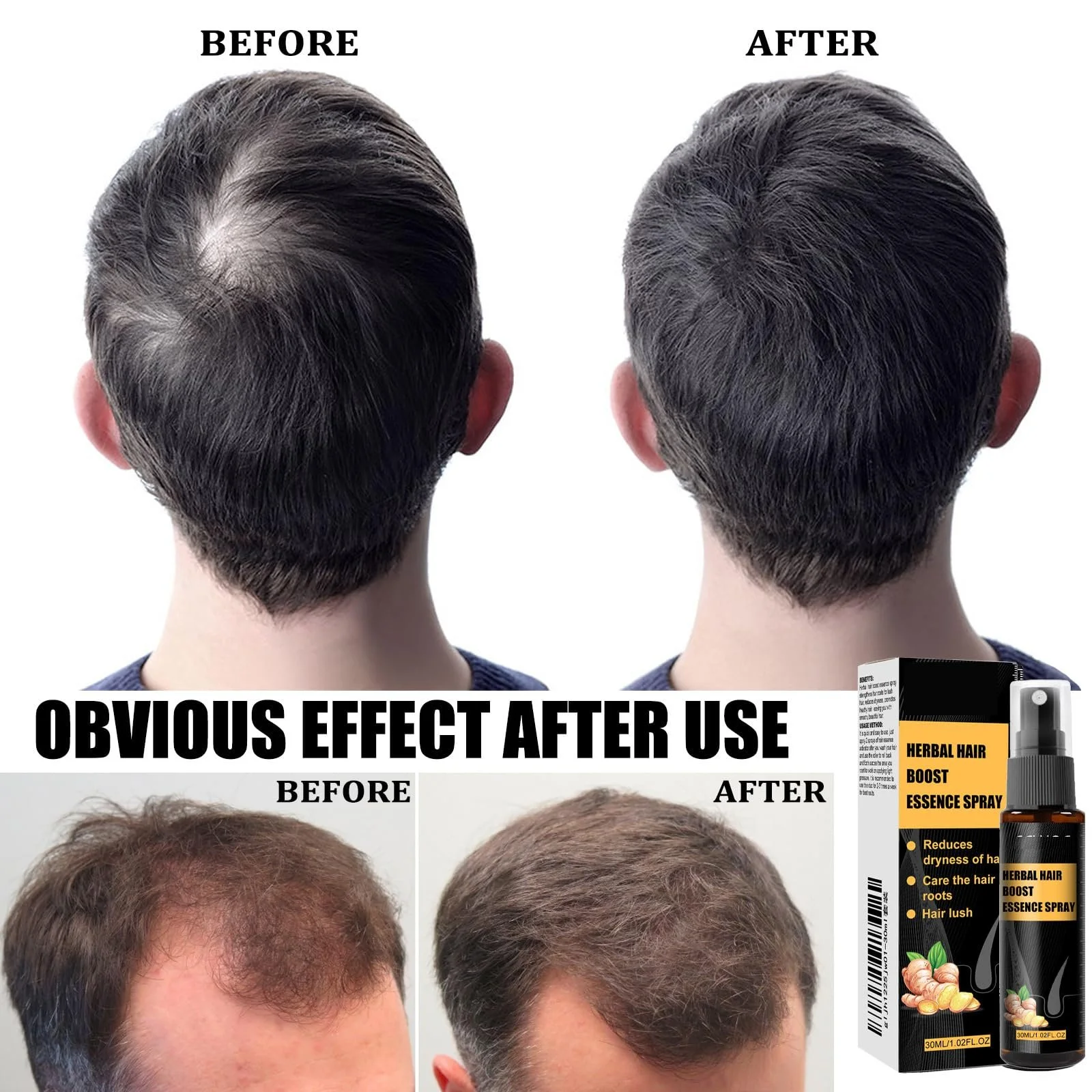 Есенція для волосся 2Hppsctink, для зміцнення коренів волосся, сироватка, 2 шт x 30 мл, шампунь, фото №6