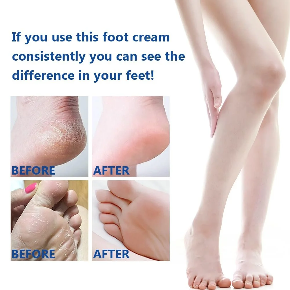 Крем для ног Hydrating and Anti-Cracking Urea Cream увлажняющий против сухости и трещин, фото №6 Крем для ног Hydrating and Anti-Cracking Urea Cream увлажняющий против сухости и трещин, фото №6