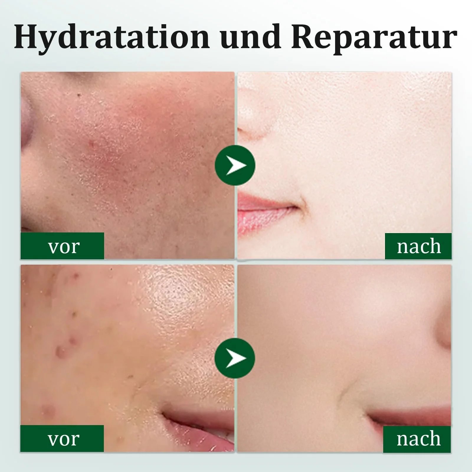 Маска для лица Soleneva, набор 6 штук, успокаивающая, увлажняющая маска для лица для всех типов кожи, тканевые маски для лица с различными фруктовыми ингредиентами, фото №6