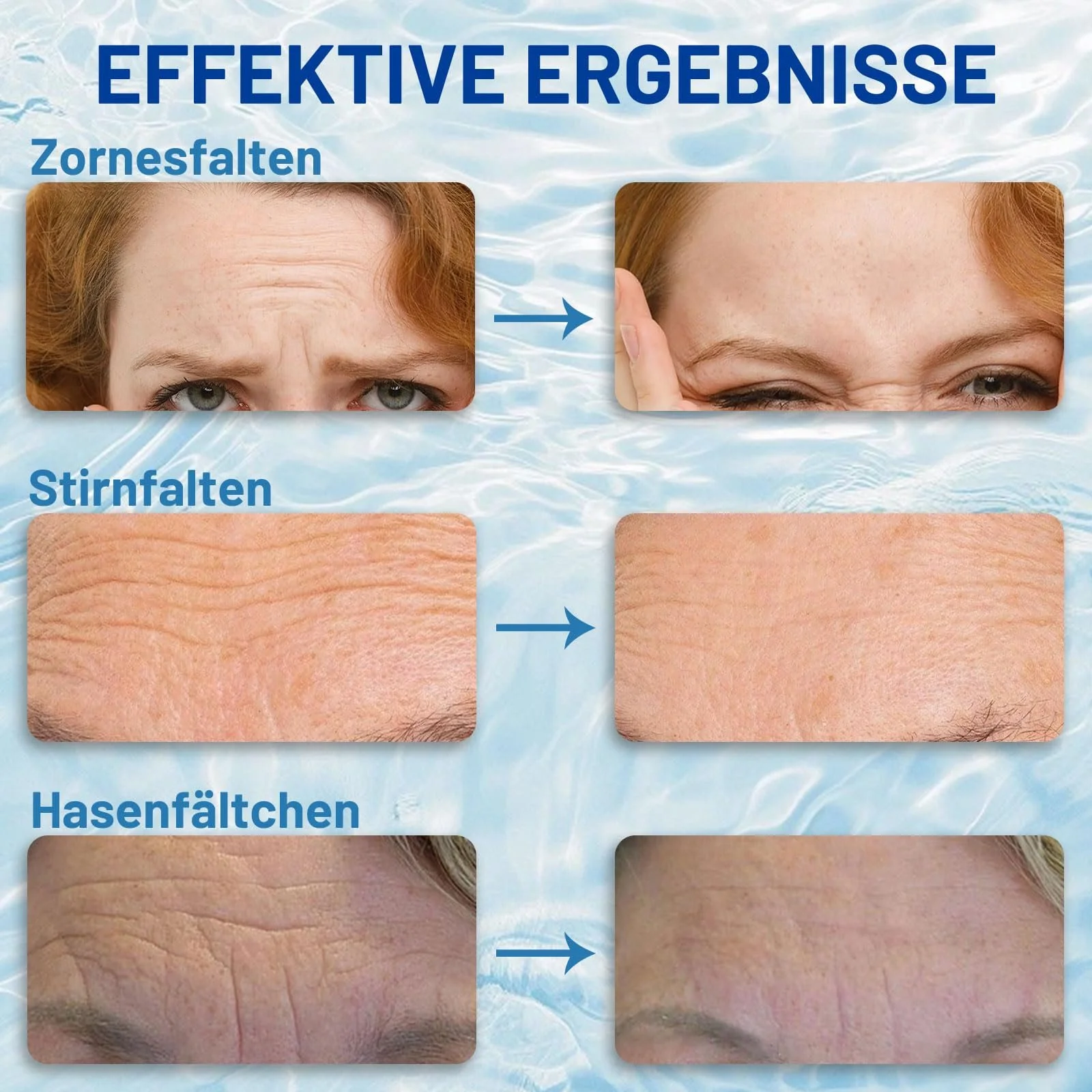 Пластирі проти зморшок з колагеном та алое вера для живлення та підтяжки обличчя, фото №5 Пластирі проти зморшок з колагеном та алое вера для живлення та підтяжки обличчя, фото №5