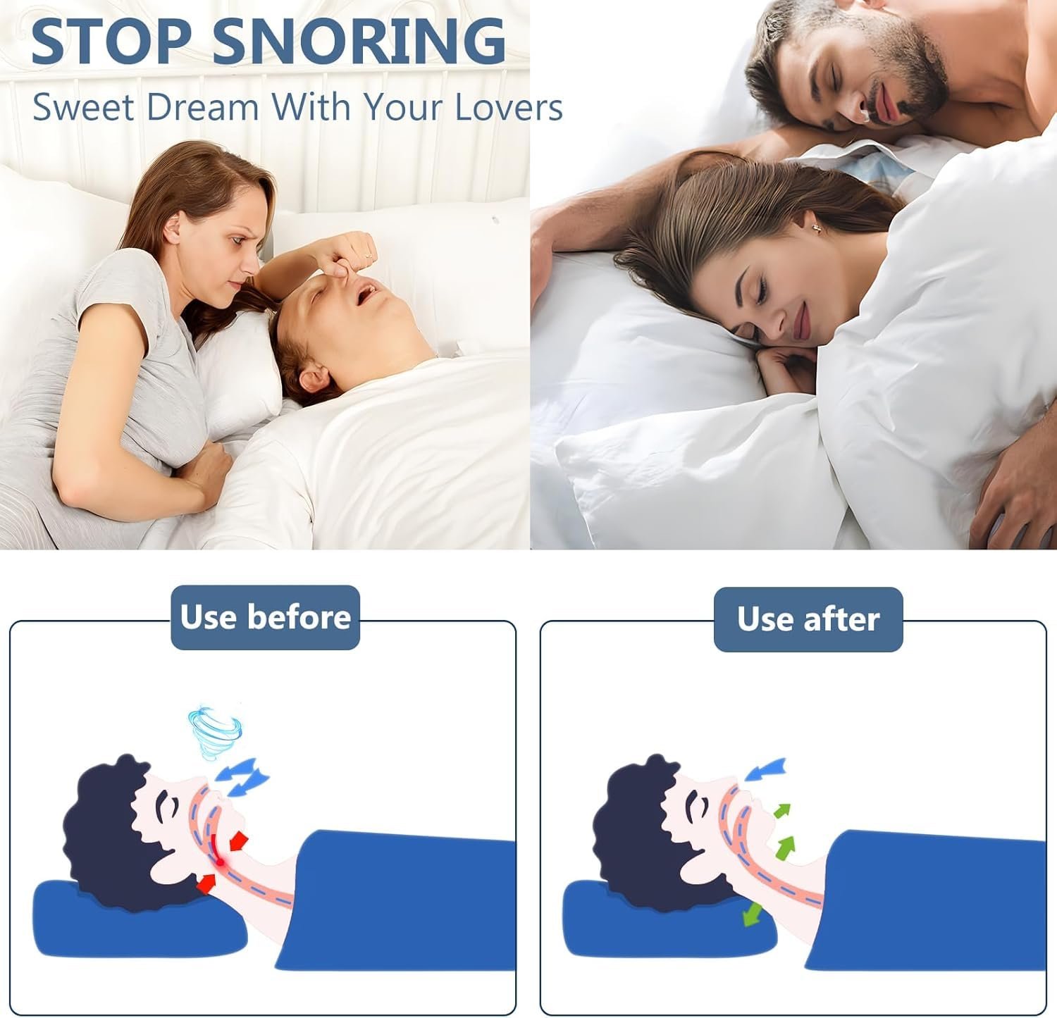 Кліпса проти хропіння 6 шт., Стопор, фото №6