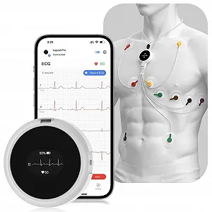 Электрокардиограф Wellue LP12 Черный - Фото 1