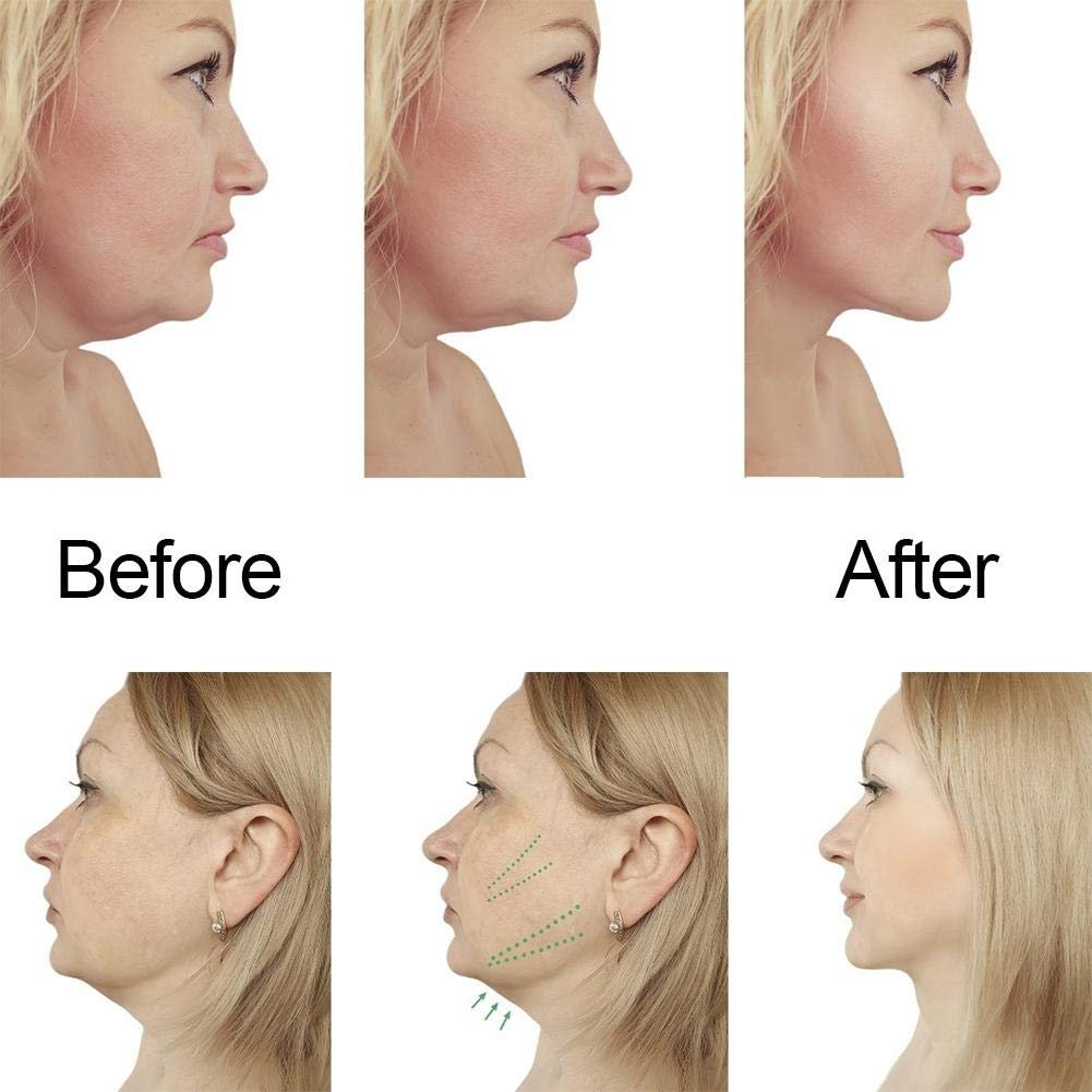 V-Line Маска для обличчя та шиї для догляду за обличчям Зволожуюча та зміцнююча, фото №5