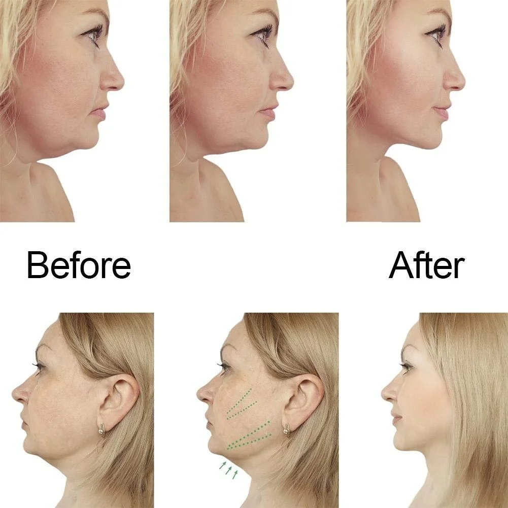 V-Line Маска для лица и шеи для ухода за лицом Увлажняющая и укрепляющая, фото №5