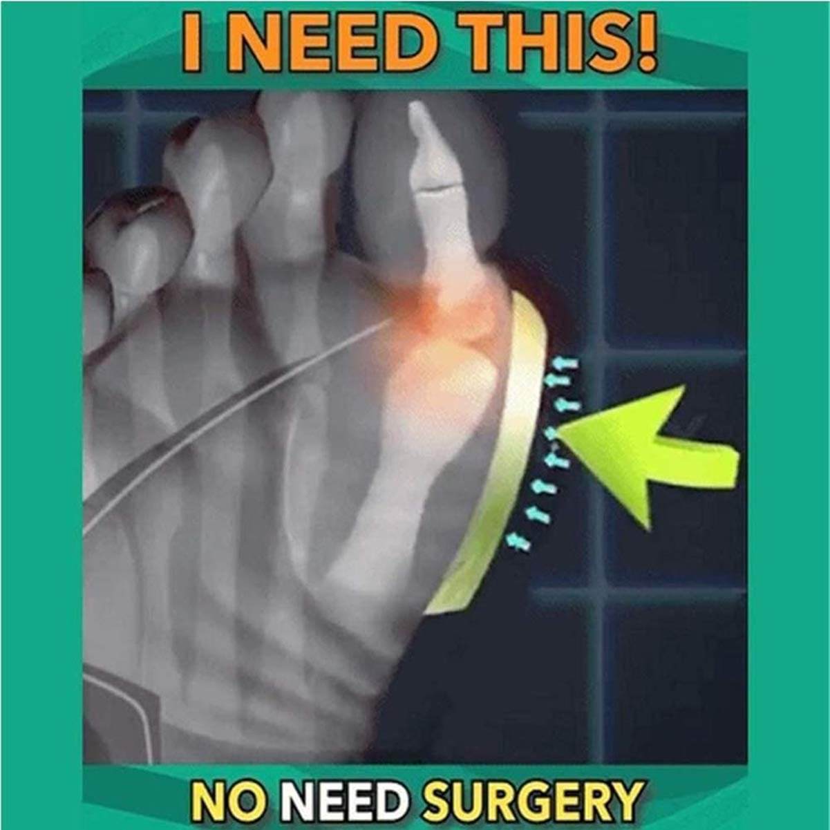 Удобные Шлепанцы CrEev для женщин Ортопедическое, фото №8