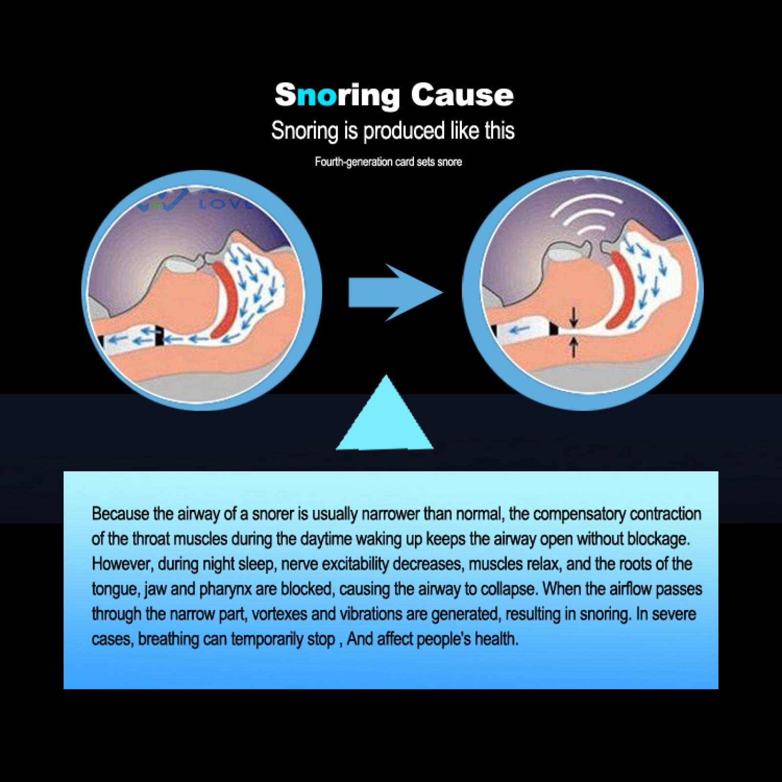 Тримач язика проти хропіння Силіконовий, фото №3